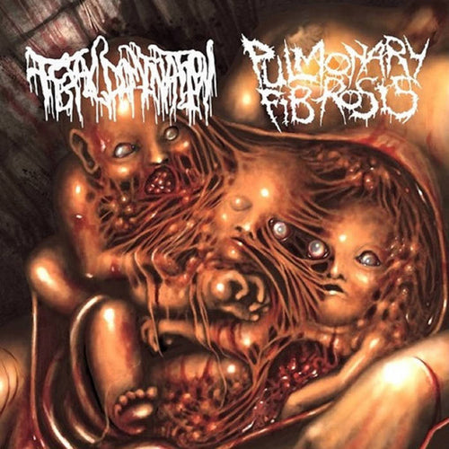 Pulmonary Fibrosis / Fetal Domination - Split Goregrind France/Spain CD